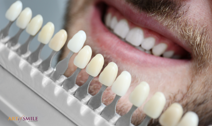 Art of Smile - Yonge and Eglinton